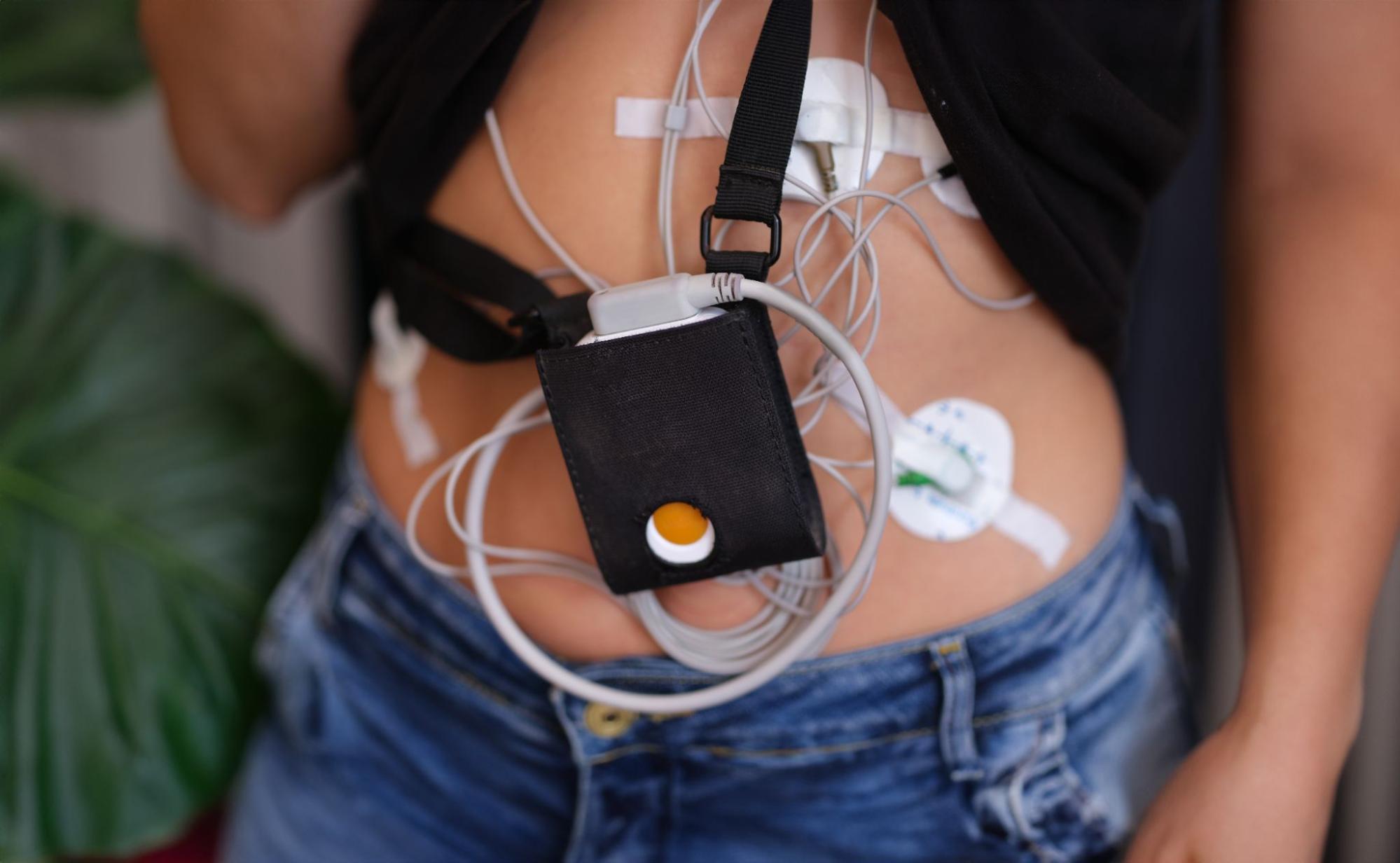 Pacient s pripevneným Holter monitorom