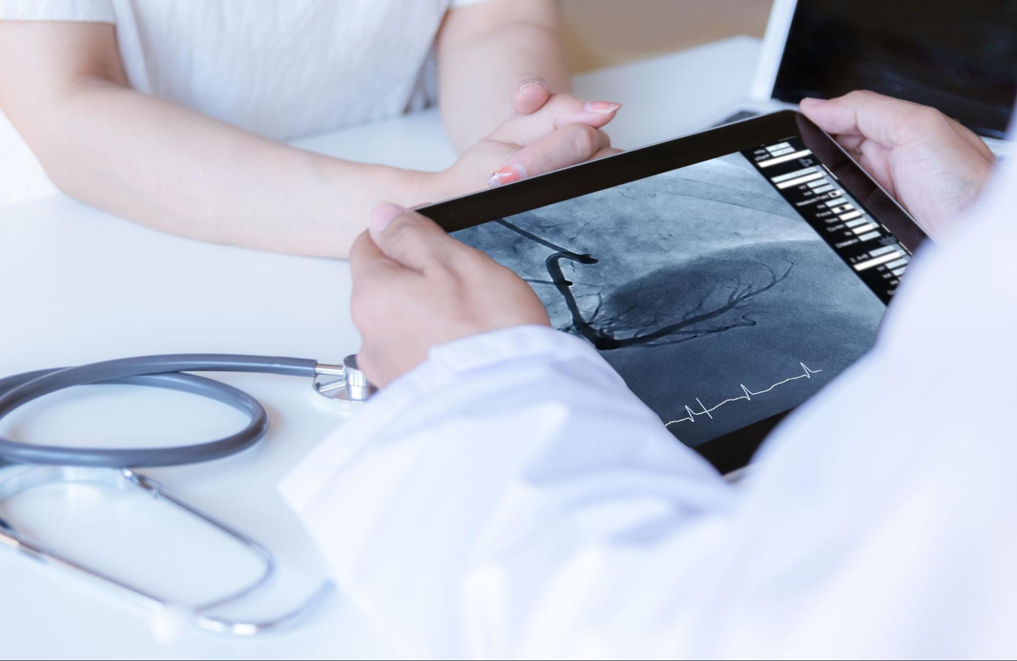 Lekár ukazuje pacientovi výsledky koronárnej angiografie na tablete