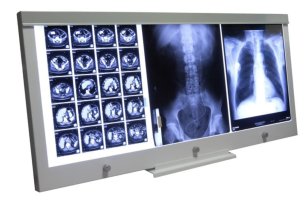 Negatoskop LED NGP 31 - Nástenný