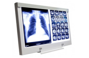 Negatoskop LED NGP 21 - Stolový