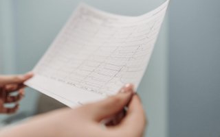 ekg krivky výsledok